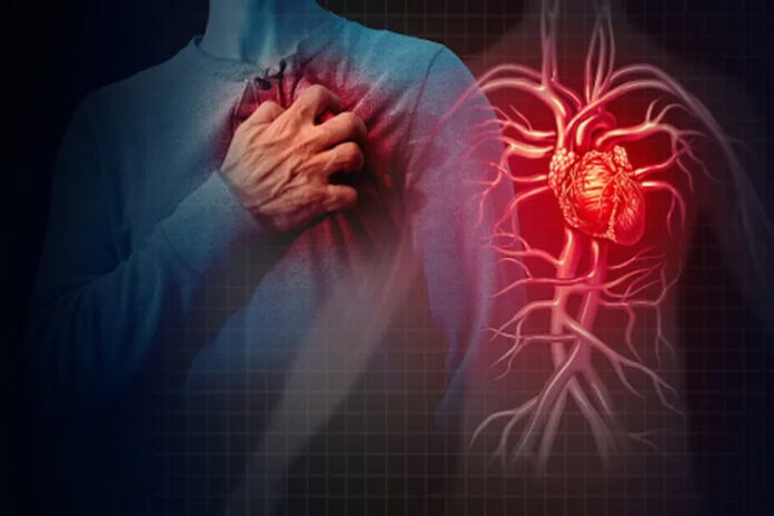 CARDIAC-696x464 Experts Flag Cardiac Dangers Linked To Extreme Workouts, Unsupervised Supplement Use